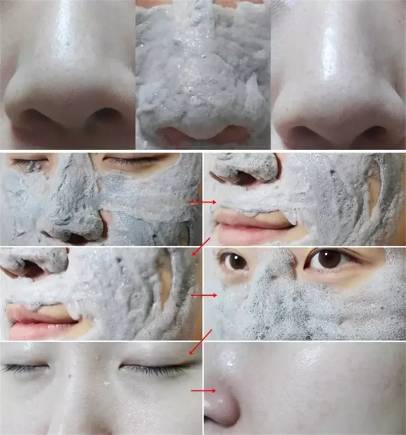 Что будет после маски. Глиняная маска до и после. Глиняная маска для лица до и после. Маска из глины для лица. Глина для лица.